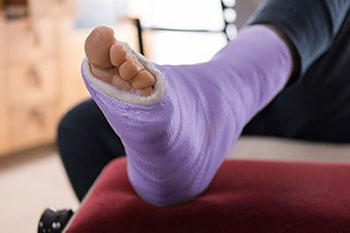 fracture treatment in the Ottawa County, MI: Grand Haven, Grand Haven Charter Township, Spring Lake Township, Park Township, Holland, Holland Charter Township, Georgetown Township, Zeeland Charter Township, Muskegon County, MI: Muskegon, Norton Shores, Muskegon Township, Fruitport Charter Township, Egelston Township, Roosevelt Park, North Muskegon areas