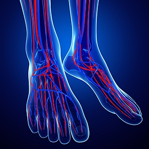Why Is Screening for Peripheral Artery Disease Important?