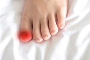 Ingrown Toenails in Children