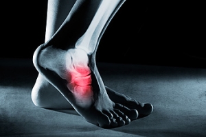Where Does Your Foot Hurt?