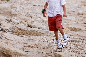 Understanding Clubfoot