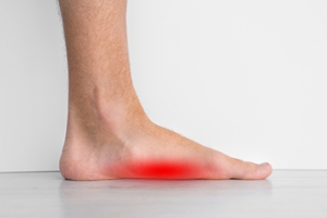Understanding the Anatomy of Flat Feet